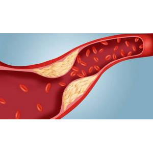 4. Giảm lượng cholesterol và lượng đường trong máu